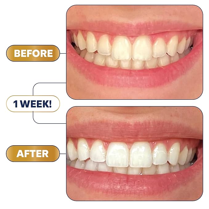 Lumineux 2-in-1 Teeth Whitening Pen, Removes Coffee & Tea Stains
