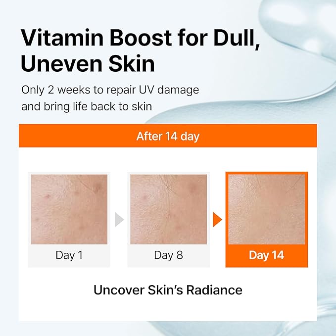 DearKlairs Vitamin C Serum | Dark Spot Care for Sensitive Skin, 1.18 fl oz