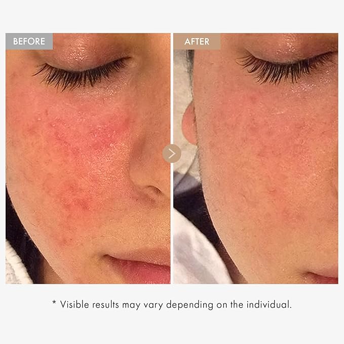 TOSOWOONG Real Oatmeal Relief Cream for Blemish & Soothing, Redness