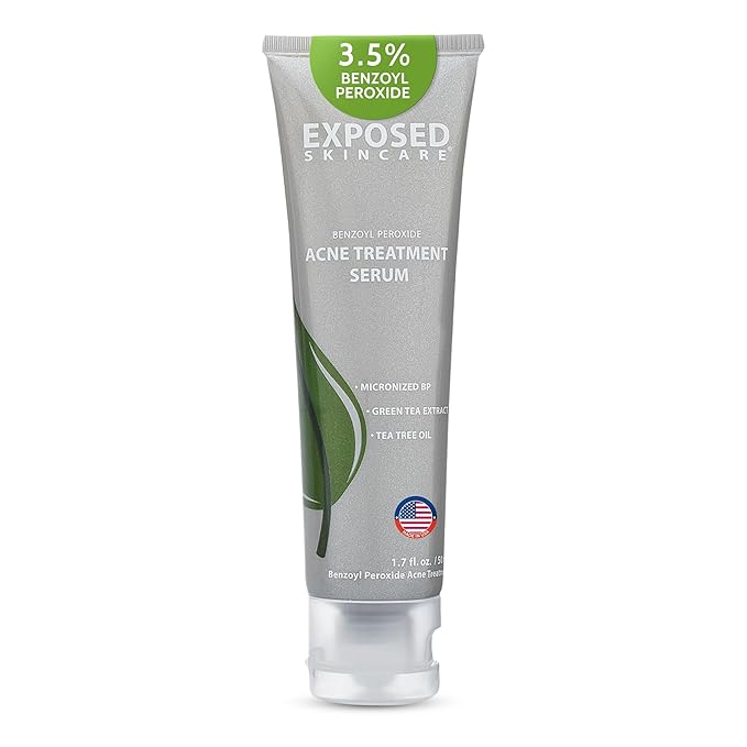 Exposed Skin Care, Acne Treatment Serum with 3.5% Benzoyl Peroxide – Lightweight Acne Spot Treatment – Quickly Clear Teen, Adult, Hormonal and Cystic Acne – Natural, Non-toxic and Cruelty Free