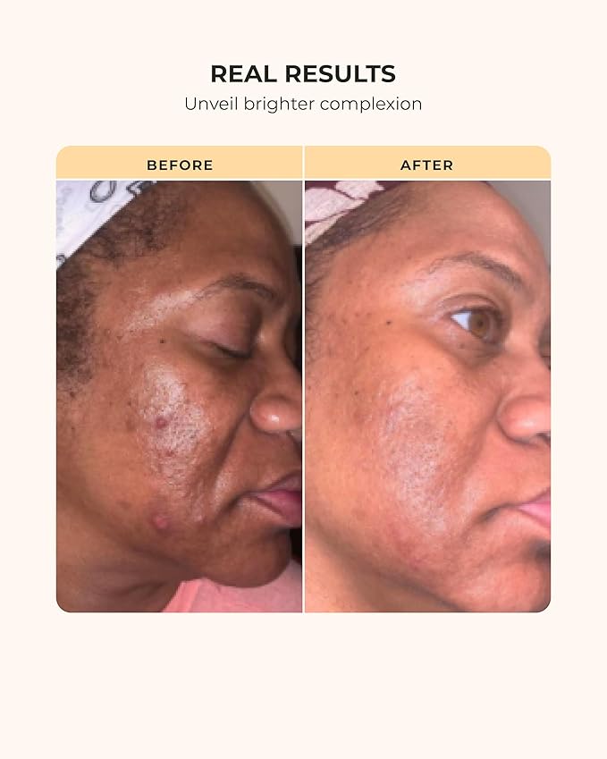 Buttah Skin 3pc Transforming Skincare Kit for Melanin | Rich Skin Revitalizing CocoShea Cream Moisturizer 2 oz | 15% Vitamin C Serum 1 oz | Buttah Cleanser 3.4 oz | Black Founded Skincare