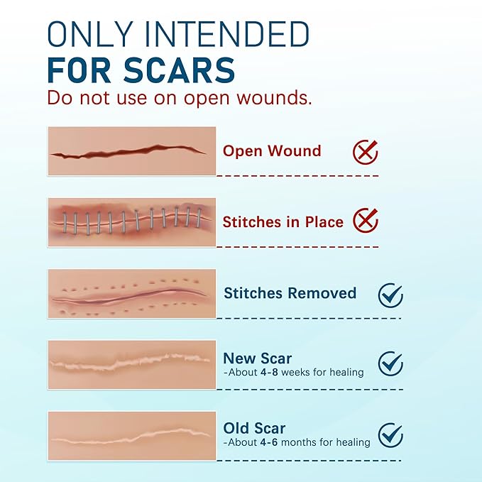 MEDLOT Silicone Scar Sheets, 10pcs, Silicone Tape for Scar Treatment, Reusable Scar Strips for Surgical, C-Section, Keloid Bump, Stretch Marks, Burn, Acne Scar Removal, Each 1.5” x 6”