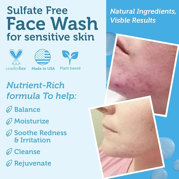 Era Organics Manuka Honey Face Wash - Gentle Cleanser for Sensitive Skin