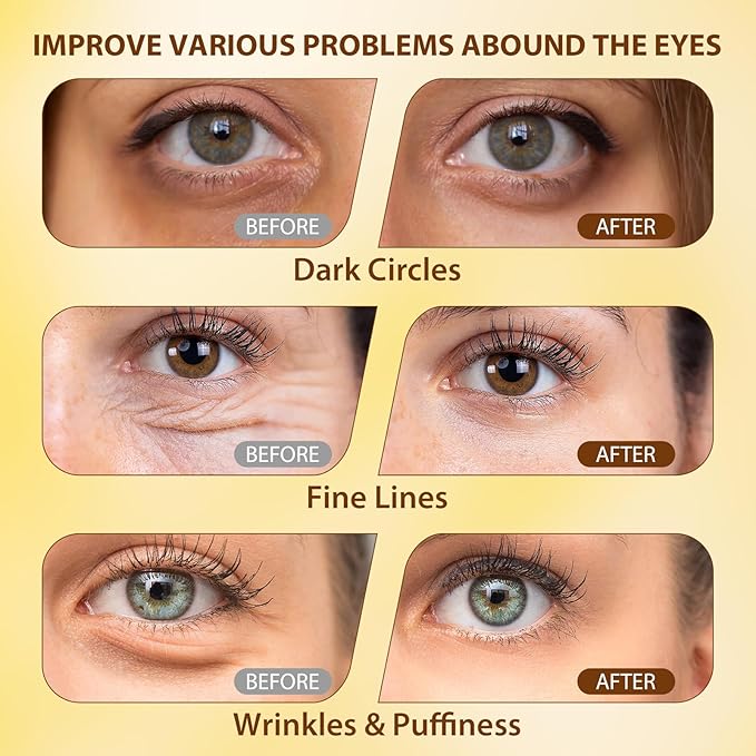 Soulight 5% Caffeine Eye Serum Anti Aging, Eye Cream Reduce Dark Circles, Puffiness, Fine Lines, Wrinkles, Hyaluronic Acid Niacinamide Eye Moisturizer with 360° Massage Ball, Eye Balm for Men & Women