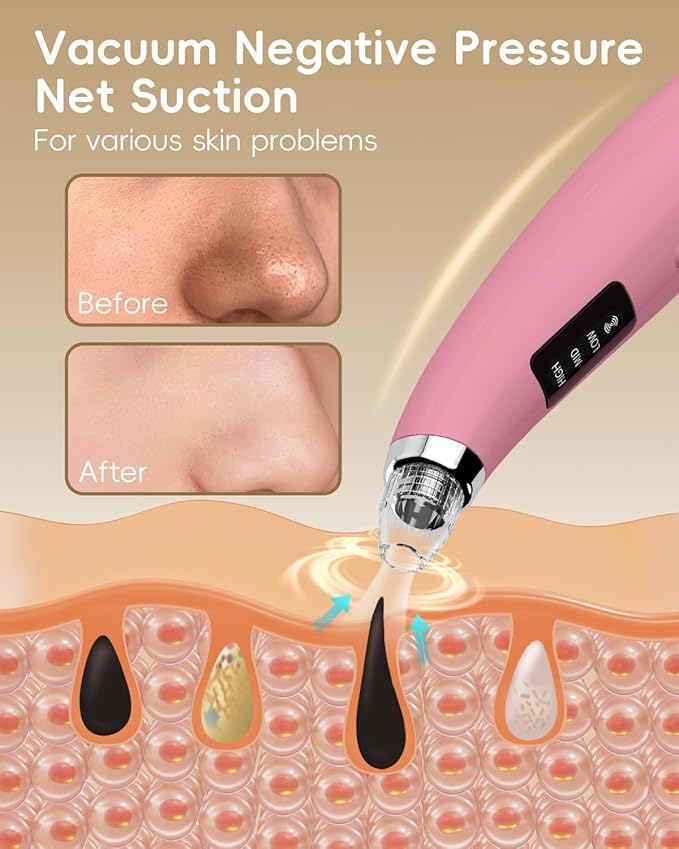 Blackhead Remover Pore Vacuum - Blackhead Remover for Face with 5 Attachments & 3 Suction Levels - Blackhead Vacuum removers for Women & Men (Matte Pink)