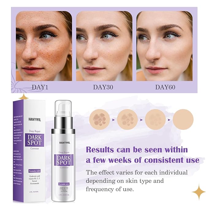 HANYWIL Dark Spot Remover for Face & Body Serum - 2% Retinol + 5% Niacinamide + Vitamin C for Face & Body, Melasma & Hyperpigmentation Treatment,Dermatologist Tested,1.7 Fl Oz