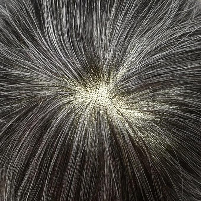 F M FACE MIRACLE NEW YORK Toupee for Men French Lace Center Mens Toupee Hairpiens Human Hair Replacement System Black Brown Blonde Gray Hair Units, 7X9