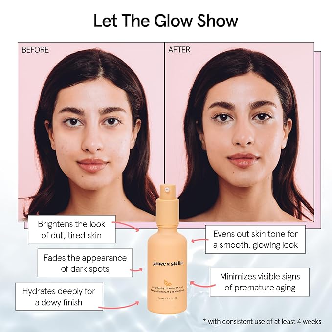 grace & stella Vitamin C Serum for Face (50ml /1.7 fl oz)