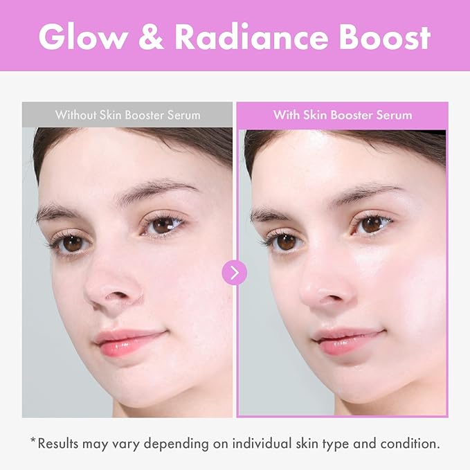 TOSOWOONG 9 Peptide Skin Booster Serum for All Skin Types, Dark Spots, Glow
