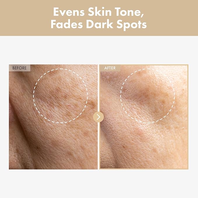 TOSOWOONG Rice Glow Milky Toner for Glass Skin & Hydration, Dark Spots