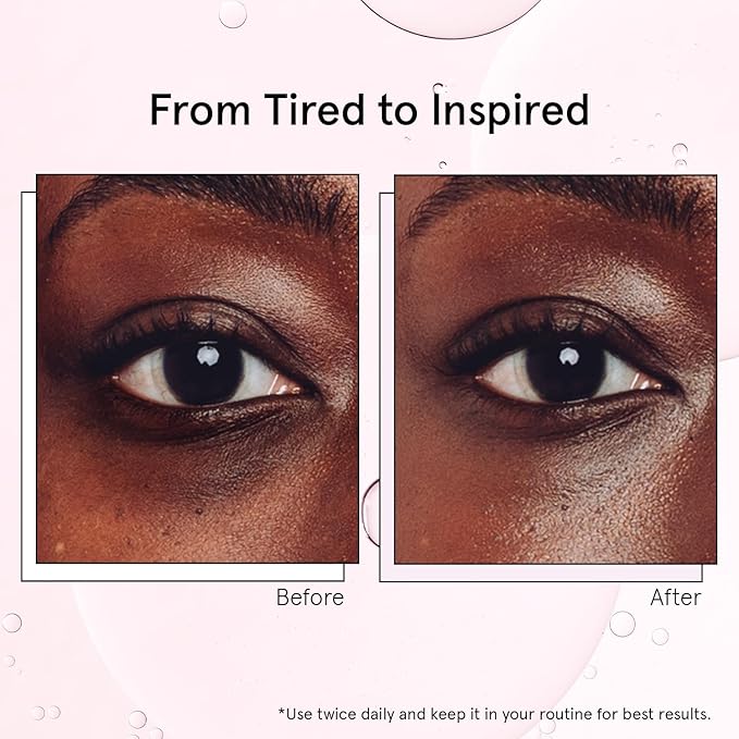 grace & stella Under Eye Brightener with Cooling Metal Rollerball - Centella Asiatica & Caffeine Eye Serum for Puffy Eyes - Travel Essentials - Under Eye Cream - Travel Essentials (15ml / 0.51floz)