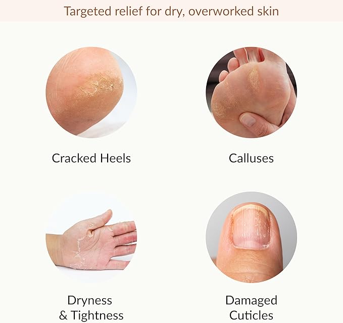 Epielle Hydrating & Moisturizing Hand & Foot Masks, Relieve and Soften Dry, Rough Skin, Self Care Gifts for Women, Spa Kit, 6 Moisturizing Gloves & 6 Moisturizing Socks