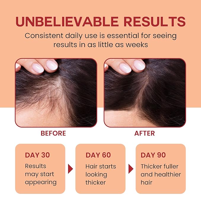 Lebanta Raw Batana Oil for Hair - 100% Pure, Organic 4oz Batana from Honduras for Fuller, Thicker-Looking Hair - Unrefined Cold Pressed Cosmetic Scalp Oil & Hair Mask, Gift for Women (1 Pack)