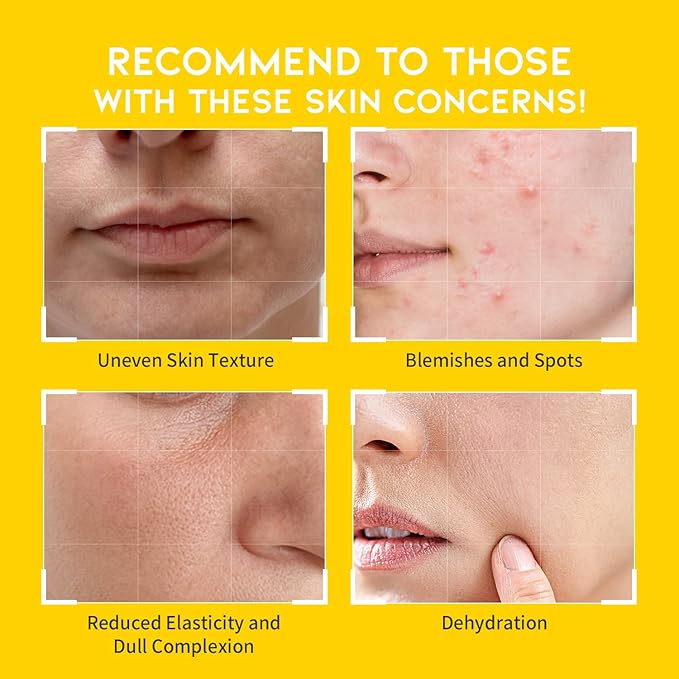 #OOTD Vitamin C Toner Pads with Niacinamide,70 Pads | Korean Skincare