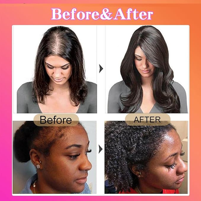 100% Raw Batana Oil for Hair Growth,Natural Raw ＆ Pure Unrefined Batana Oi
