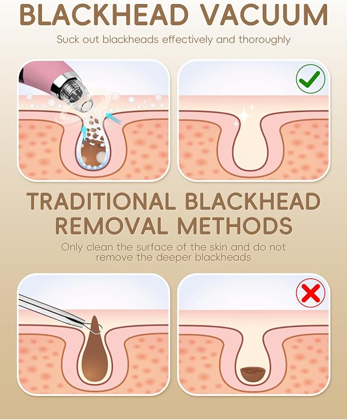 Blackhead Remover Pore Vacuum - Blackhead Remover for Face with 5 Attachments & 3 Suction Levels - Blackhead Vacuum removers for Women & Men (Matte Pink)