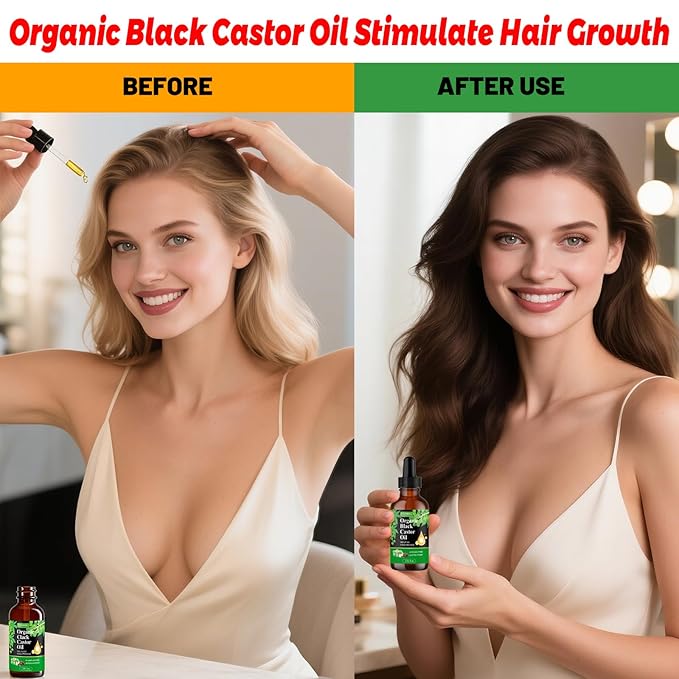 Etimisa Organic Black Castor Oil,100% Pure Natural,Cold Pressed, Glass Bottles, Hair,Eyebrow Care, Skin Care, Castor Oil for Body & Carrier Oil