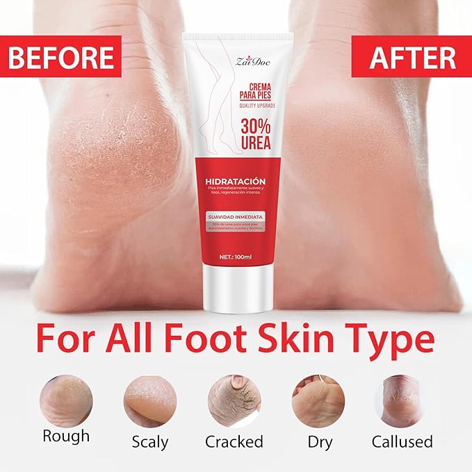 ZAIDOC Urea Cream 30 Percent for Feet 3.38 oz, Foot Cream and Hand Cream Maximum Strength with Hyaluronic Acid, Aloe Vera for Deep Moisturizes, Callus Remover
