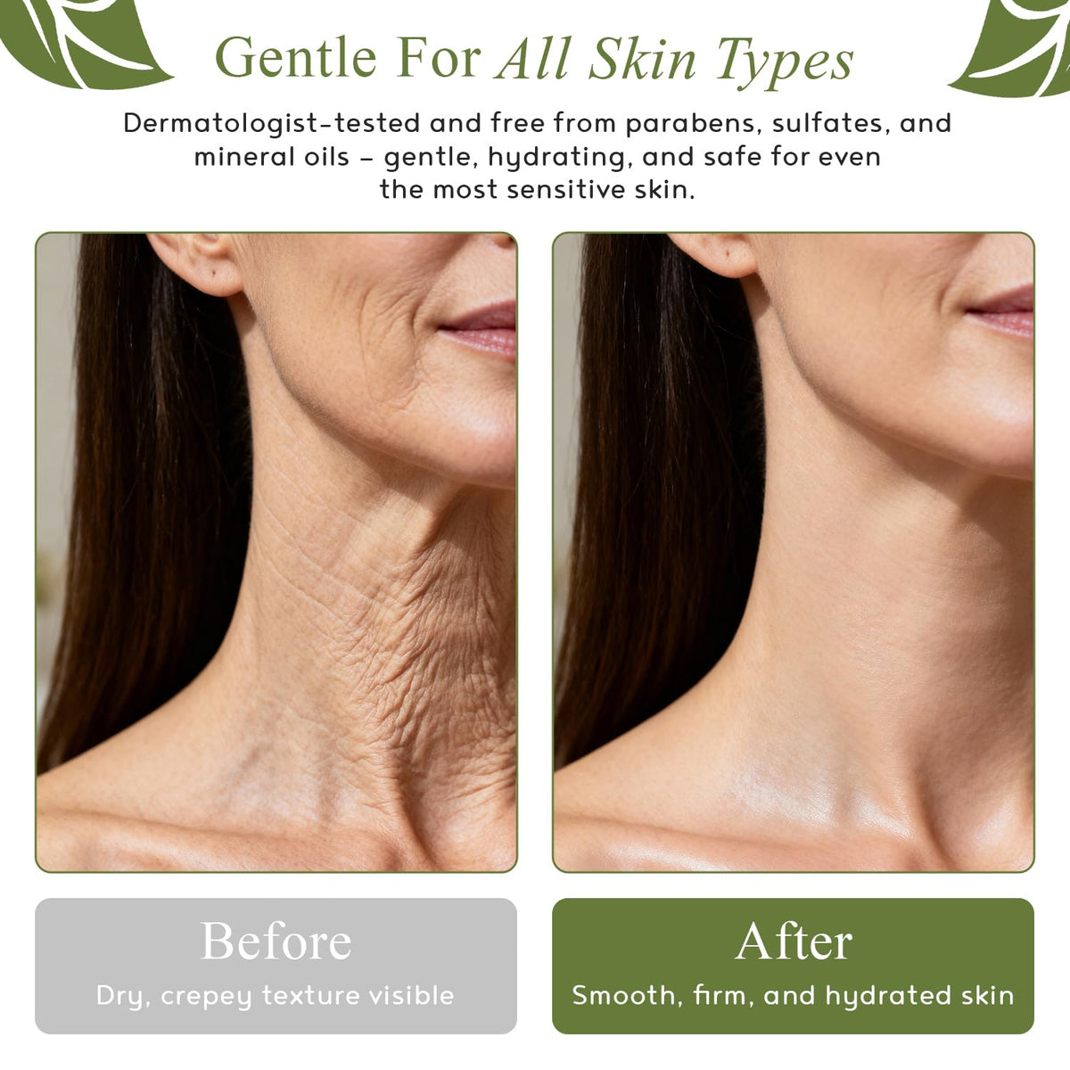 M.D. Blend Crepe-Ease Body Moisturizer for Crepey Skin, Firming Cream, 4 Oz