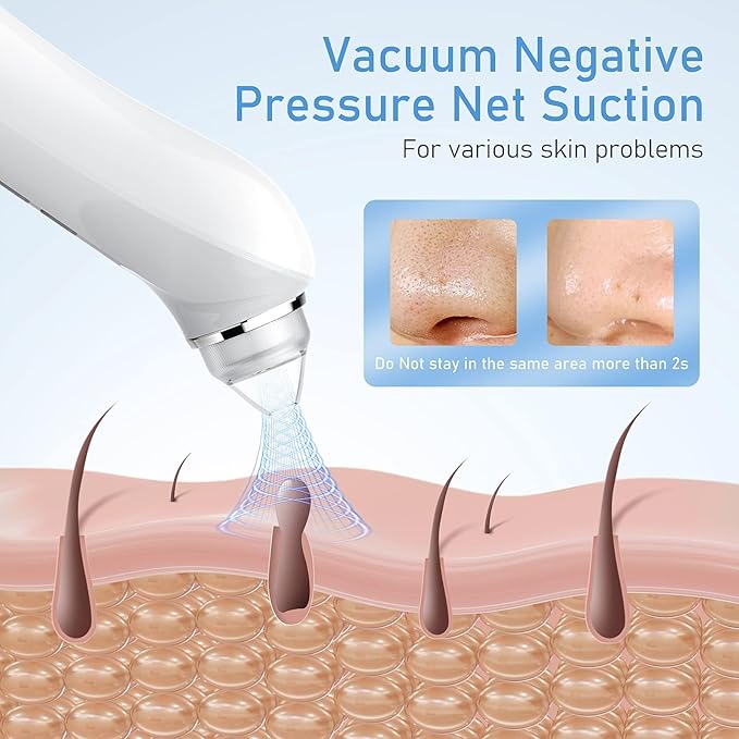 Facial Pore Blackhead Remover Vacuum, 1080P Camera Blackhead Remover, 20x Zoom, 8 LEDs ＆ 3 Suction Modes, 800mAh Battery & USB - 6 Heads Pore Cleaner Kit for Women&Men(Green)