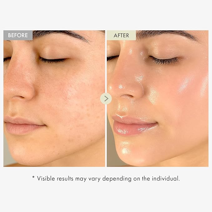 TOSOWOONG Real Collagen Face Serum for Firming & Fine Lines, Wrinkles, Dewy