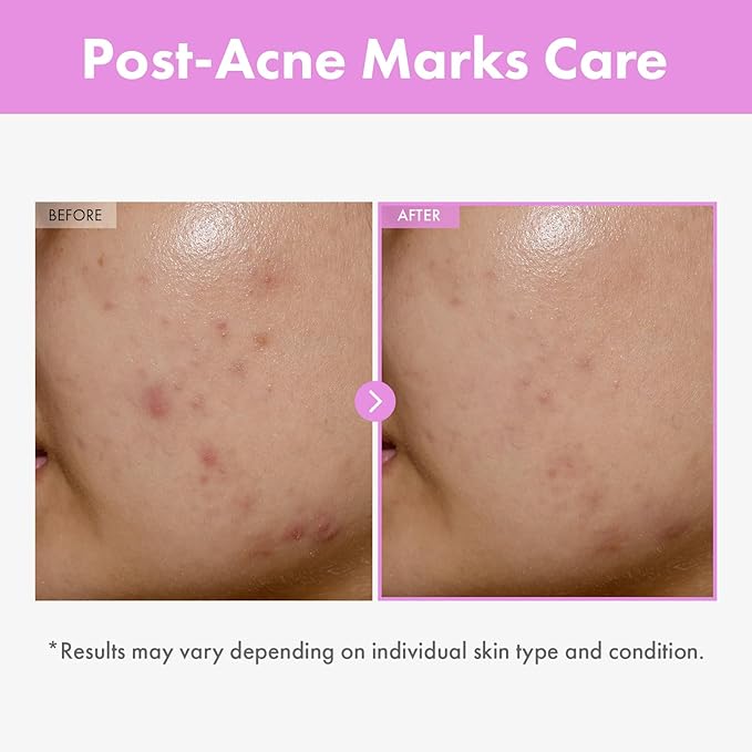TOSOWOONG 9 Peptide Skin Booster Serum for All Skin Types, Dark Spots, Glow