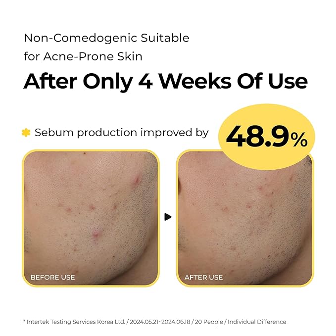 SINSURU Sulfur Hot Spring Water 82% Soothing Serum with Ceramide, Panthenol, Hyaluronic acid, Hydrating, Glass skin, Non comedogenic, for Dry Skin, Acne-Prone, Korean Skin Care (1.79 fl.oz. 53ml)
