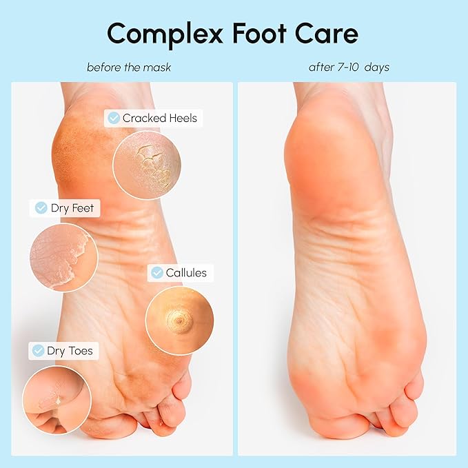 MAREE Foot Peeling Mask – 3-in-1 Foot Mask for Dry Cracked Feet, Callus Remover – Dead Skin Exfoliating Foot Peel Mask with Glycolic Acid – Moisturizing Socks for Men – Spa Self Care Gifts for Women