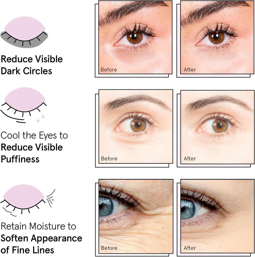 grace & stella Award Winning Under Eye Mask Reduce Dark Circles, Puffy Eyes, Undereye Bags, Wrinkles, Gel Under Eye Patches, Get Well Gifts for Women - Vegan Eye mask (24 Pairs, Blue)
