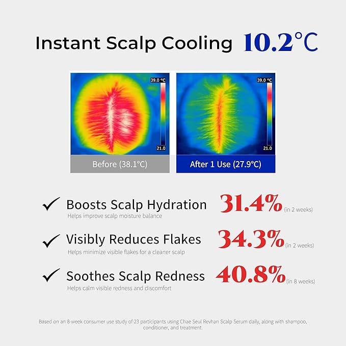 ChaeSeul Revhan Scalp Serum for Hair Loss & Thinning – Hair Growth Serum for Men & Women w/Salicylic Acid & Centella Asiatica – Soothes Itchy, Irritated Scalp with Roll-On