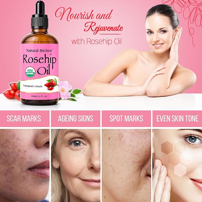 Natural Riches Rosehip Seed Oil 4 Fl Oz for Face, Skin, Hair & Nails