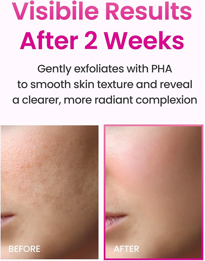 YADAH Collagen Hydra First Essence, 5.07 fl oz, Hydrating First Step