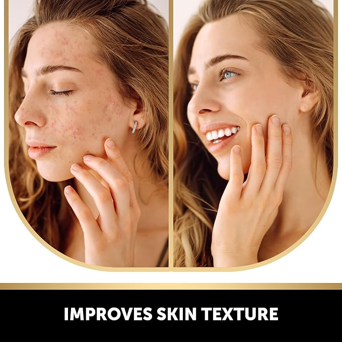 VALITIC Kojic Acid Soap for Hyperpigmentation - with Glutathione, Collagen & Vitamin C - Natural Soap Bars with Turmeric - Original Japanese Complex for Dark Spot Correction - 4 Pack + Holder