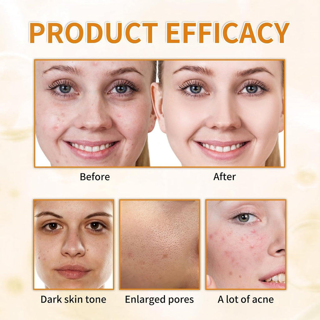 7% Glycolic Acid Exfoliating Toner, Exfoliating Facial Toner, Pore Minimizing Toner, Smooth Skin, Even Tone, Hydrating Formula