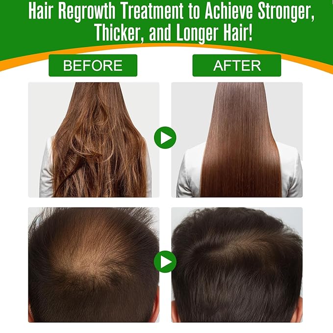 Akeeronn Batana Oil for Hair Growth,60ml 100% Pure Natural Cold Pressed Organic Oil,Promotes Hair Growth for Men & Women,Hydrating & Repairing Dry,Damaged Hair Skin Care,Enhances Hair & Skin Radiance
