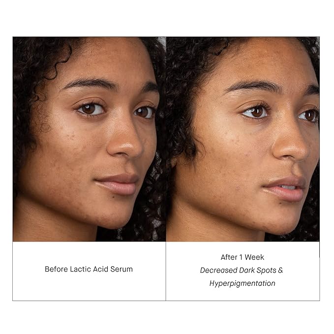 SHANI DARDEN SKINCARE Lactic Acid Face Serum Travel Size, Active PM Serum to Brighten and Smooth Skin, 0.34 fl oz