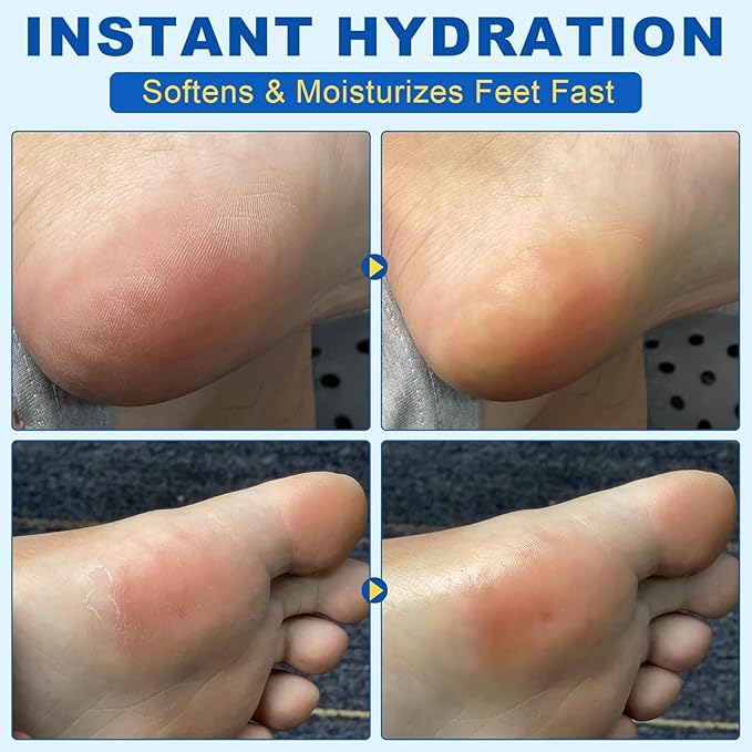 Urea Cream Stick 60% Plus 2% Salicylic Acid, Urea-Based Foot Moisturizer, Portable Foot Care No-Mess Applicator, Repairing Callus Remover for Heels, Knees, Elbows & Hands