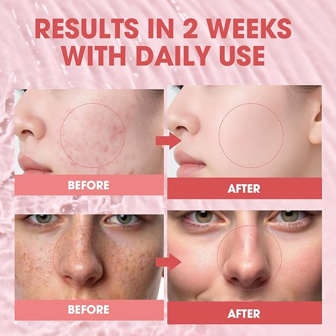 Pink PDRN Peptide Serum – Salmon DNA 10,320ppm with 12 Peptides & Niacinamide for Skin Repair, Hydration & Firming