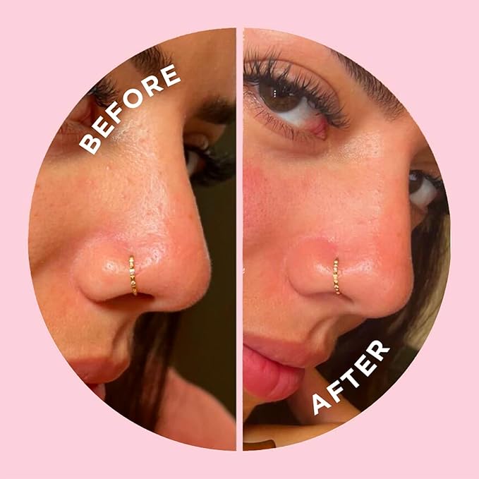 ZitSticka GooGetter Nose Pore Strips - Blackhead Remover Strips for Pore Clarifying & Blemishes - Fast-Acting & Effective - 8 Count