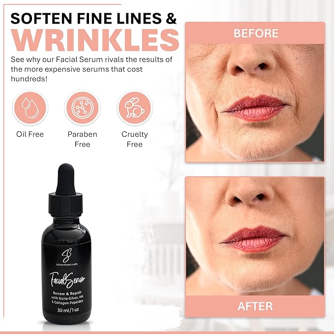 Facial Serum - Hyaluronic Acid, Collagen, Nano Silver, Acne, Wrinkles - 1oz