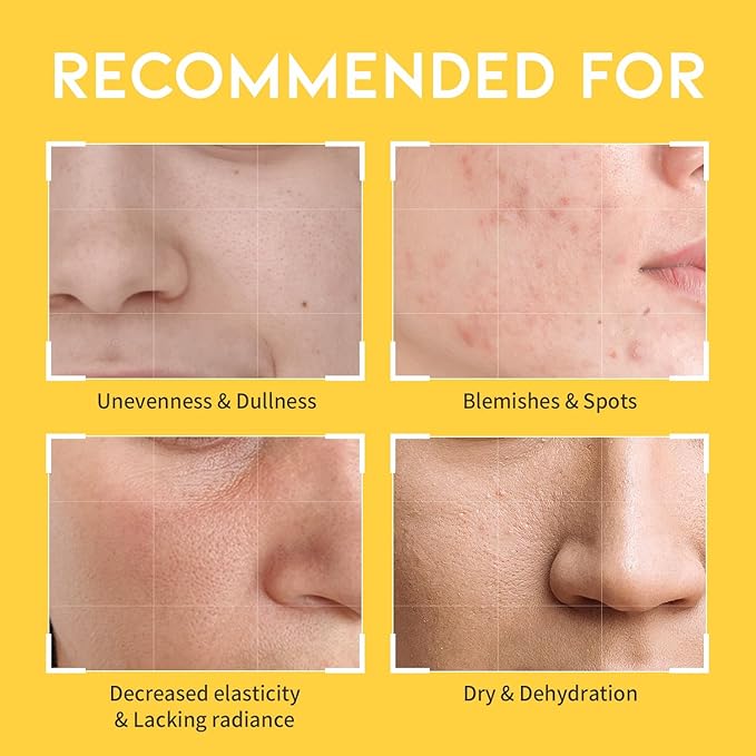 #OOTD Vitamin C Niacinamide Toner for Face, 8.45 fl oz | Korean Skincare