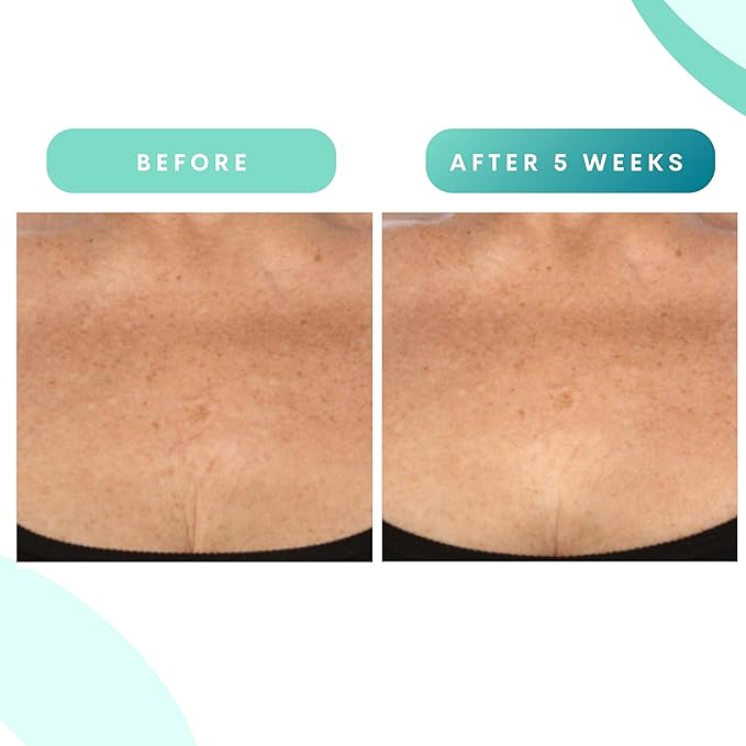 Serious Skincare, Glycolic Firming Retexturizing Body Cream with BODY FIT™, Moisturizing Lotion for Dry Skin, for Loose Crepey Skin Arms, Legs, Belly, Gentle Exfoliation for Smooth & Glowing Skin 8 Oz