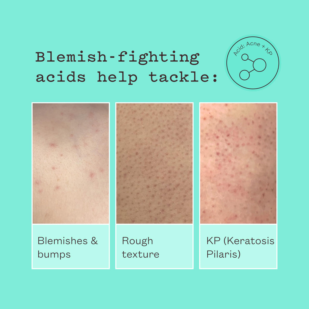 Frank Body Smoothing AHA Body Lotion | Vegan, Cruelty Free, Body Exfoliant | Fights Breakouts and Hydrates Skin with Lactic & Glycolic Acids, Hydrating Oils, & Mango Seed Butter | 4.73 fl oz / 140 ml