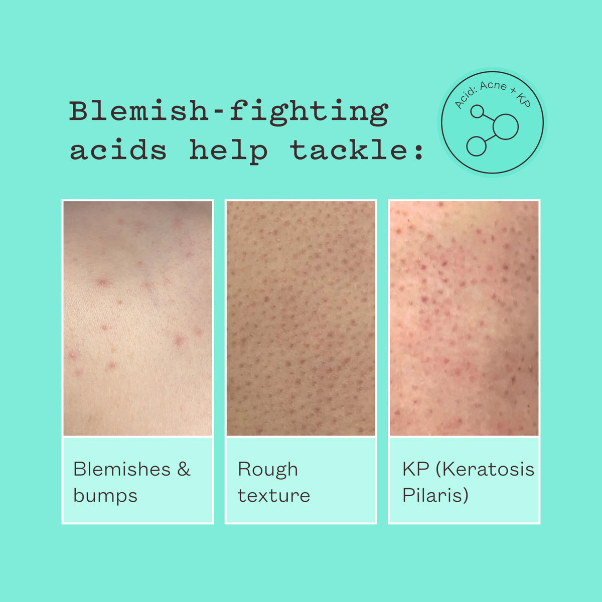 Frank Body Smoothing AHA Body Lotion | Vegan, Cruelty Free, Body Exfoliant | Fights Breakouts and Hydrates Skin with Lactic & Glycolic Acids, Hydrating Oils, & Mango Seed Butter | 4.73 fl oz / 140 ml
