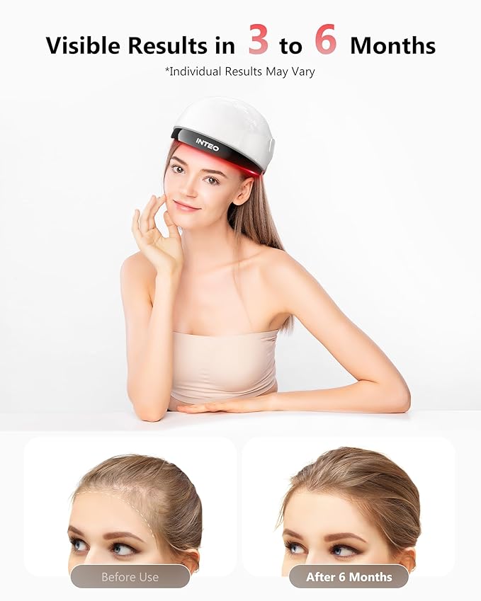 Red Light Therapy for Hair Growth with 162 Lasers