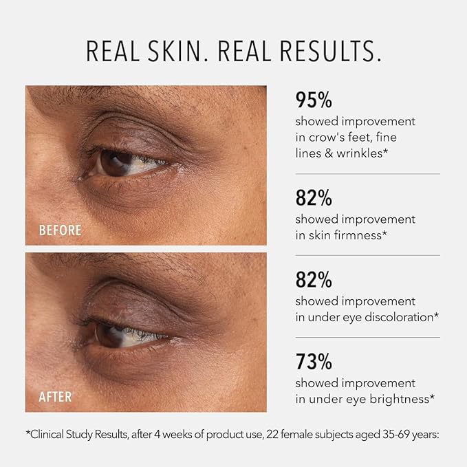 HydroPeptide: Retinol Eye Renewal Lifting & Firming Eye Balm with 0.65% Universal Tri-Retinol Complex Peptide Solution, 0.5 Ounce
