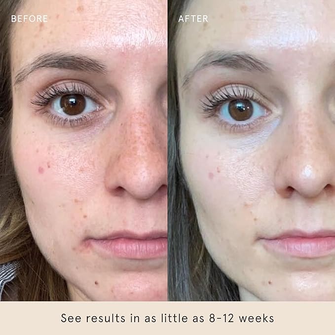 Barefaced Hydrating Lotion 1.7 Fl Oz – Oil-Free Lightweight Face Moisturizer with Niacinamide, Hyaluronic Acid & Ceramides – Daily Hydration Lotion for Balanced, Soft-looking Skin