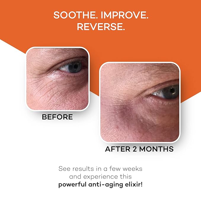 Zocufill Elixir Eye Gel and Face Serum, Fine Lines & Wrinkles Filler, 15mL