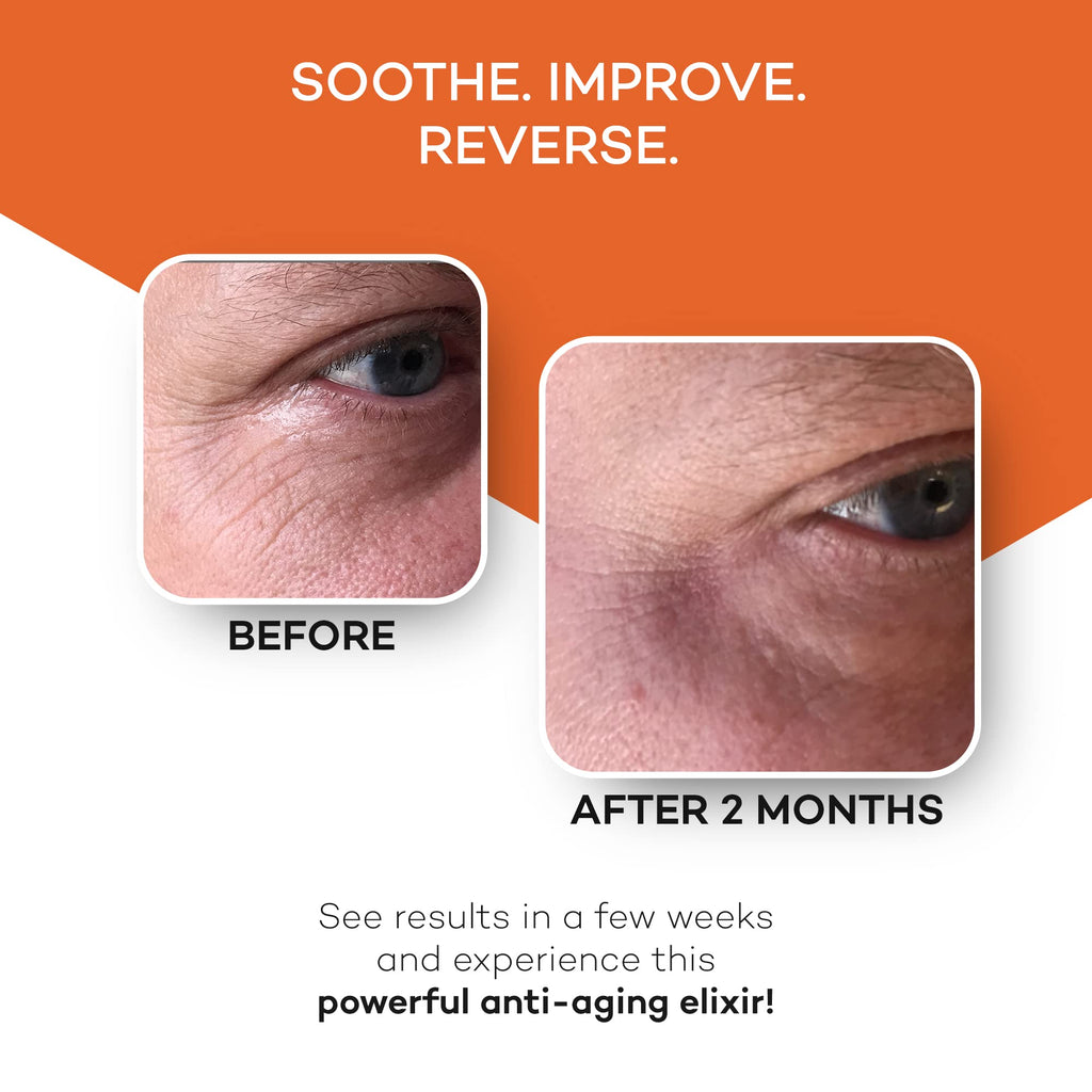 Zocufill Elixir Eye Gel and Face Serum, Fine Lines & Wrinkles Filler, 15mL