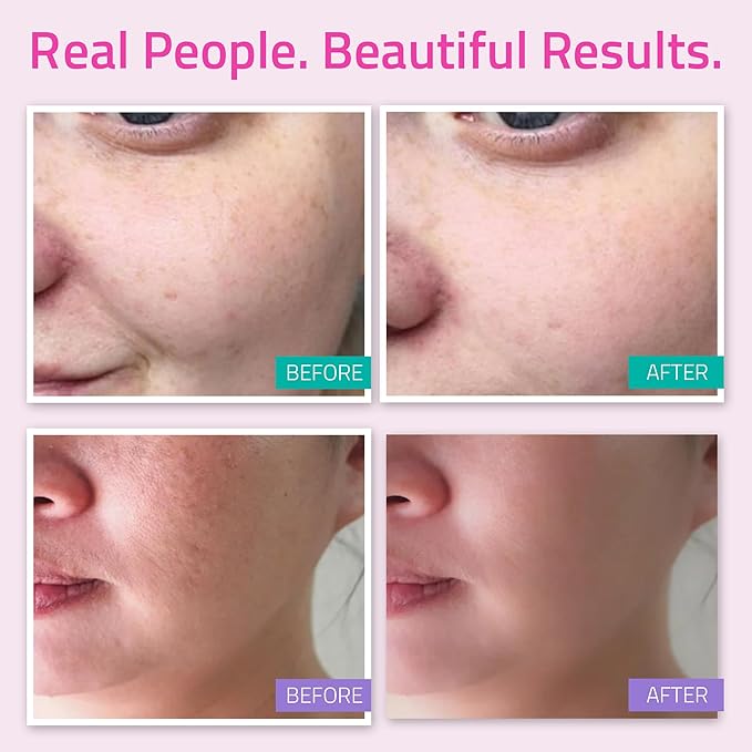 YEOUTH Skin Care Set for Complete Hydration Routine 5-Piece